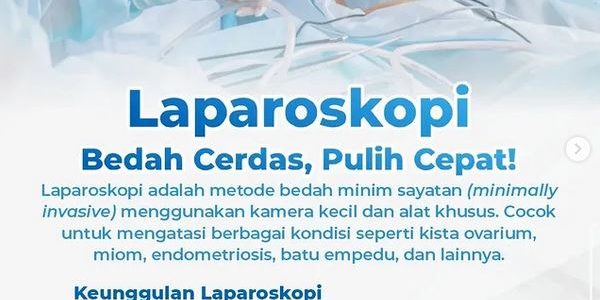 Laparoskopi Laparoskopi