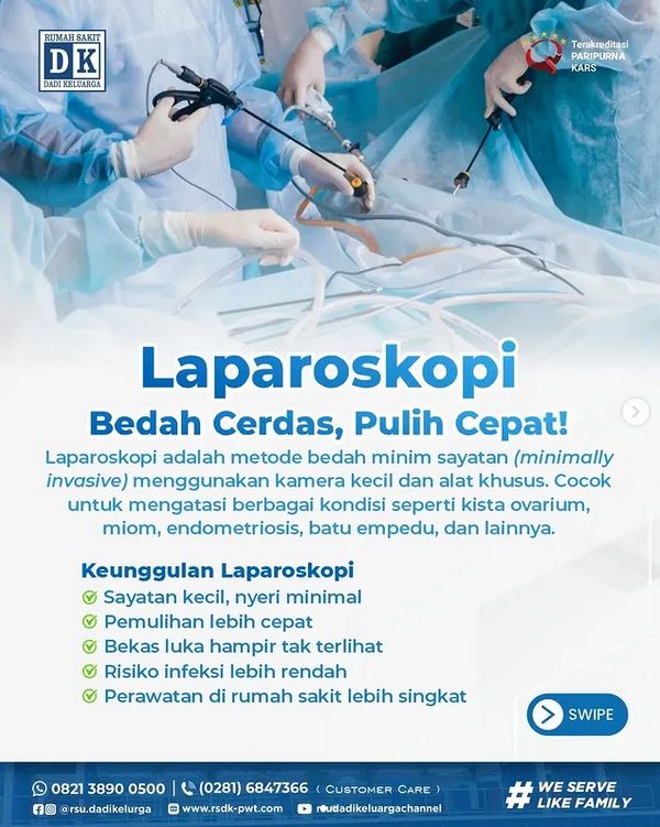 Laparoskopi