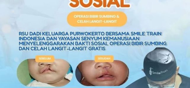 Bakti Sosial “Operasi Bibir Sumbing & Celah-Celah Langit” Bakti Sosial “Operasi Bibir Sumbing & Celah-Celah Langit”